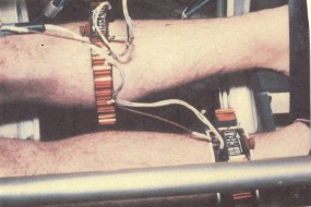 File:Gowen - Figure 013.jpg