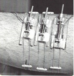 File:Gowen - Figure 004.jpg